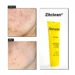 Zitclean Cleansing Gel