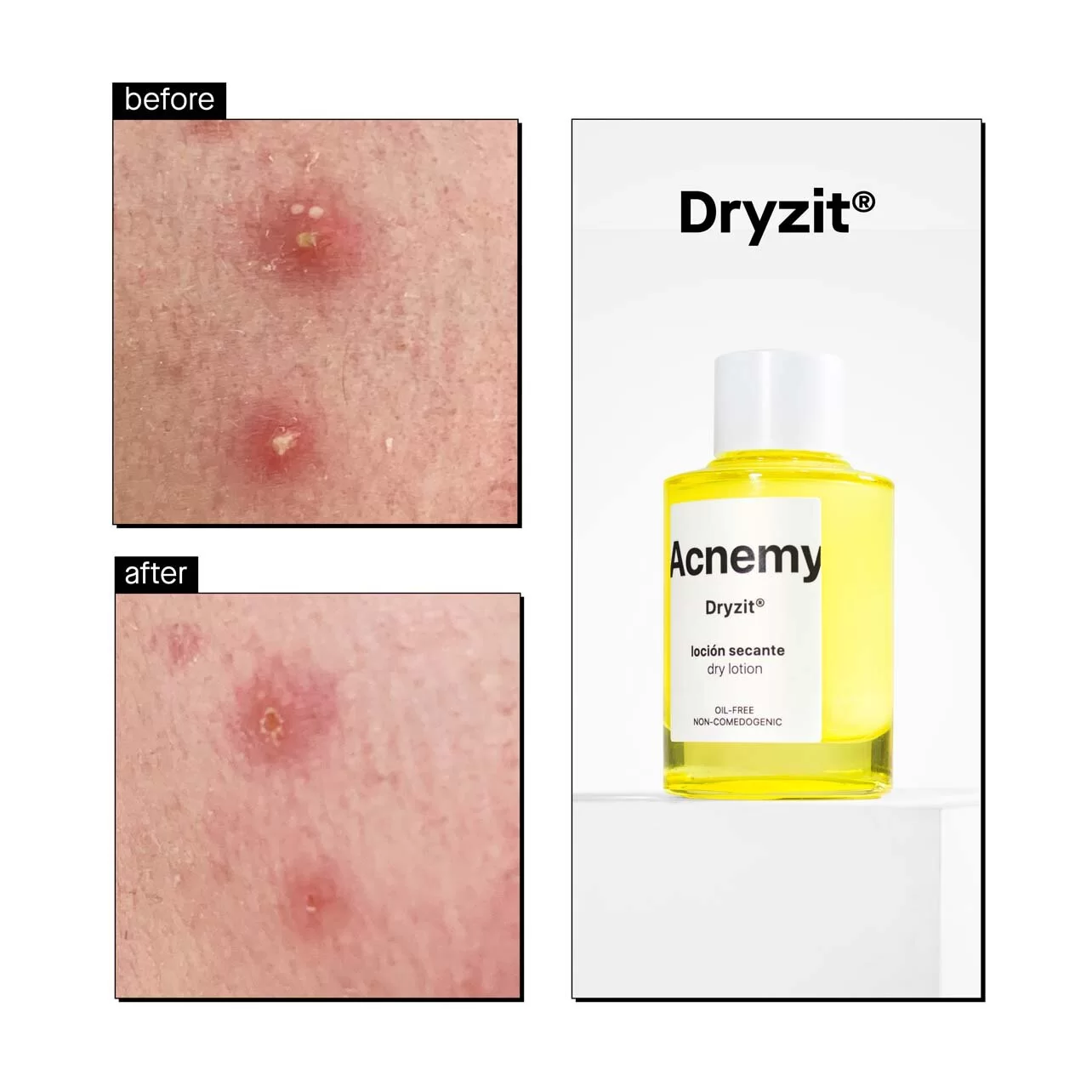 Dryzit результат до і після