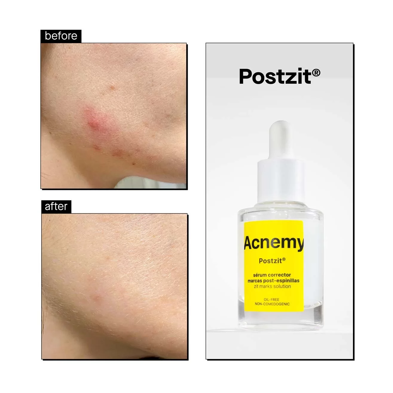 Postzit результат до і після