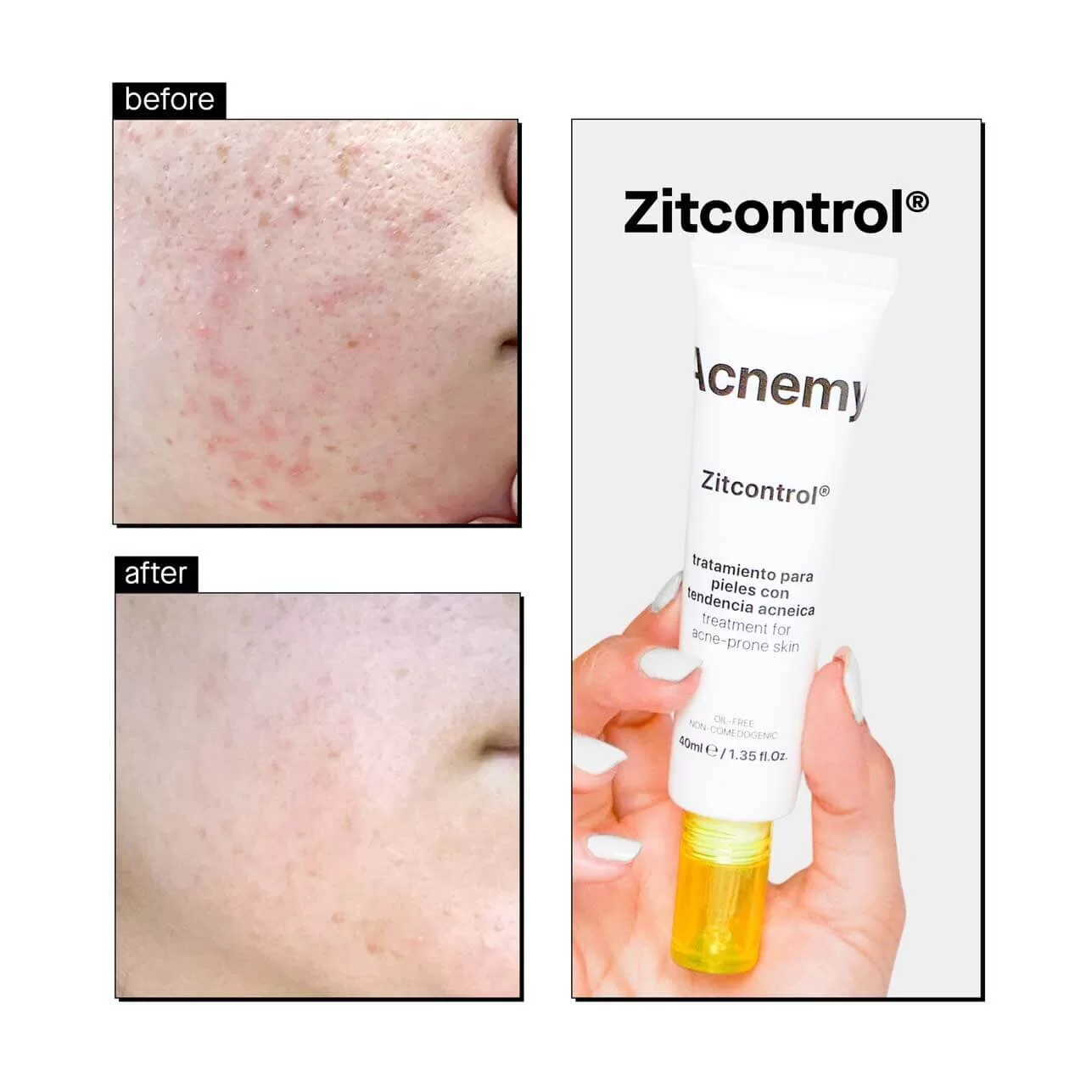 Zitcontrol результат до і після
