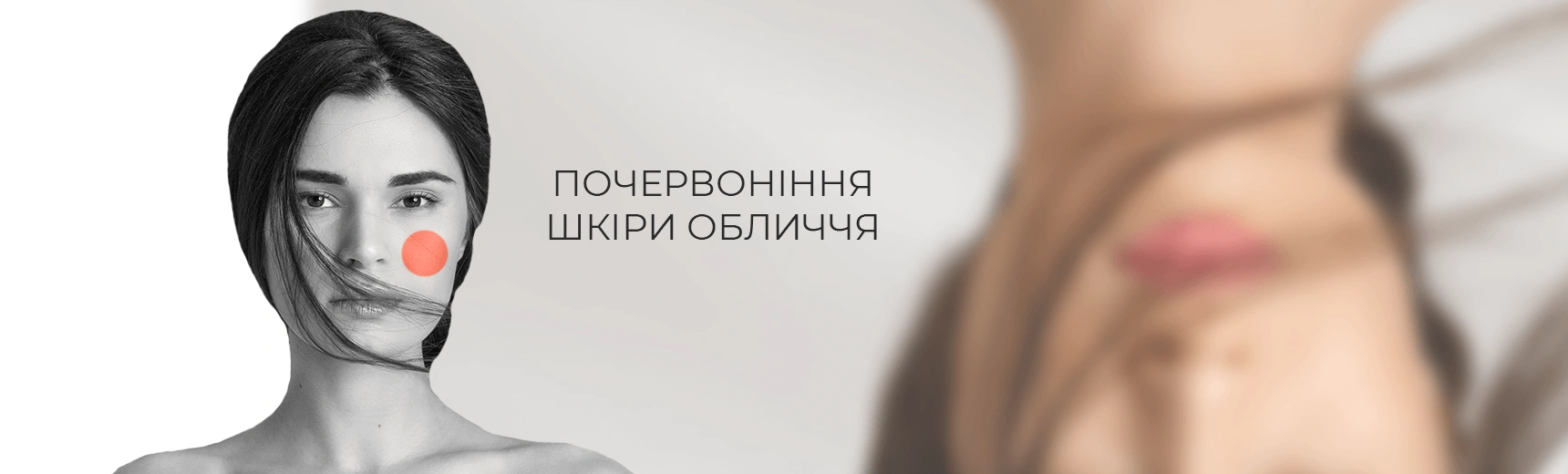 Почервоніння шкіри обличчя