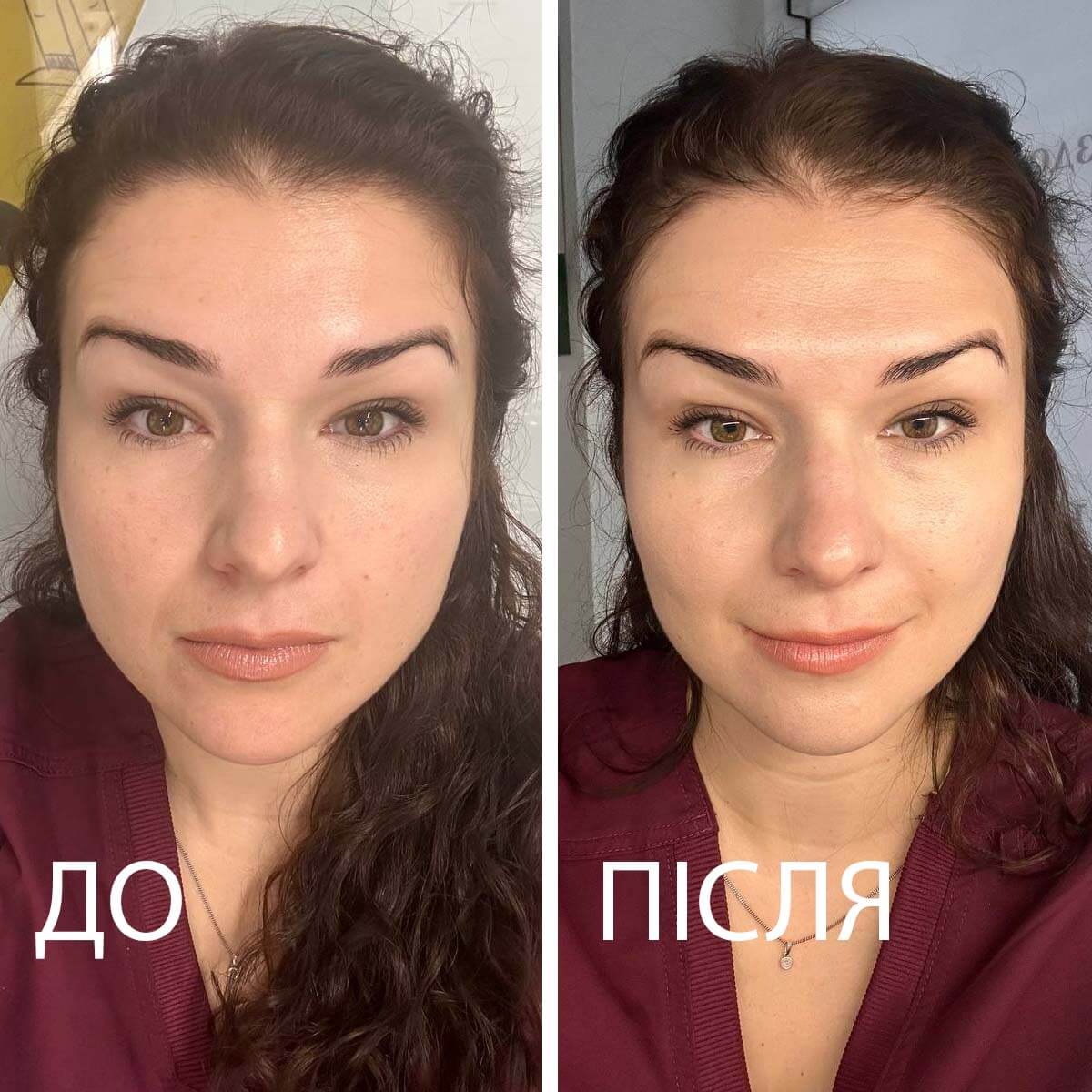до і після тканинна маска Rejuran
