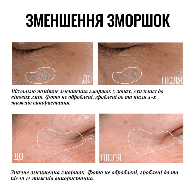TRULY-TRANSFORMING BRIGHTENING EYE CREAM