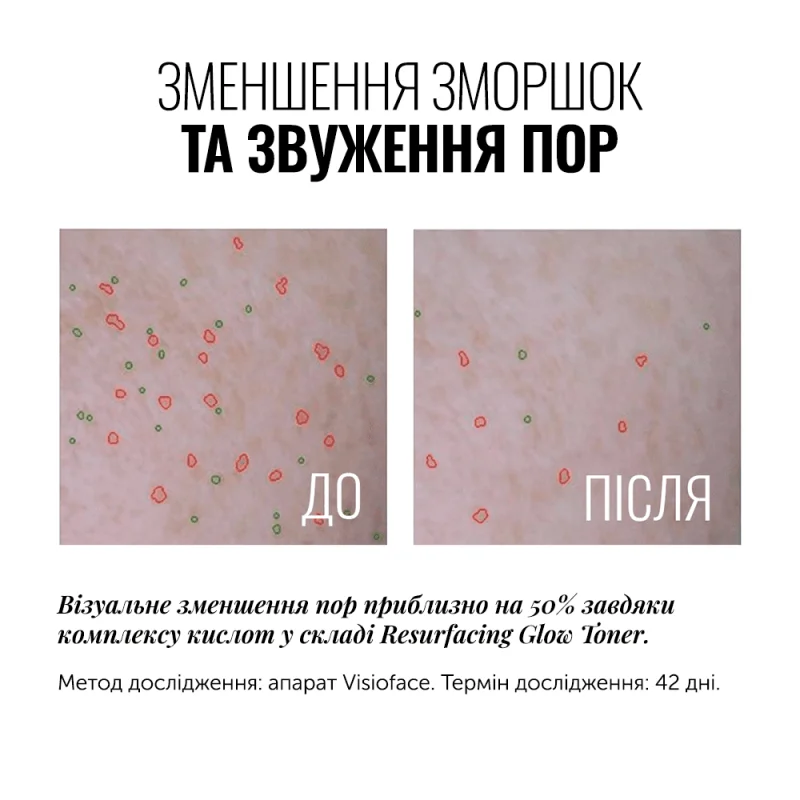 Instytutum Resurfacing Glow Toner результат до і після